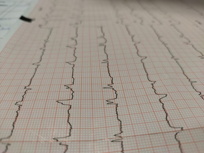 Electrocardiogram 6821777 960 720.jpg